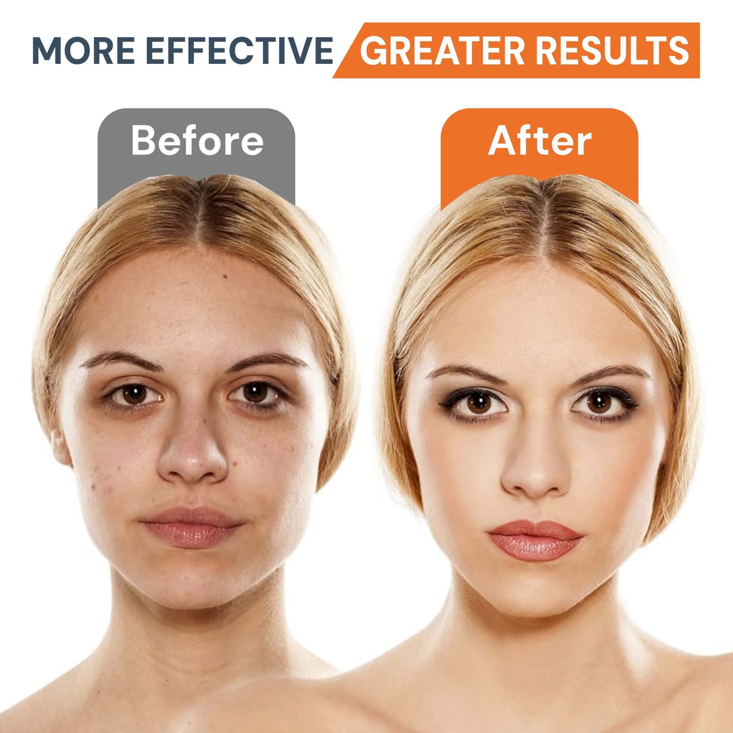 Face Electric Massager | Anti-Aging | Skin Tightening | Wrinkle Reducer