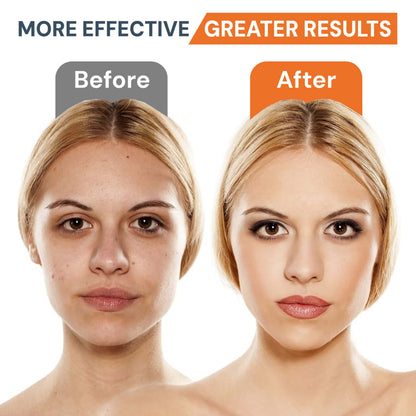 Face Electric Massager | Anti-Aging | Skin Tightening | Wrinkle Reducer