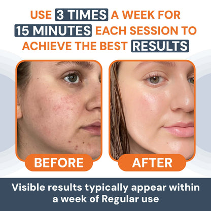 Face Electric Massager | Anti-Aging | Skin Tightening | Wrinkle Reducer